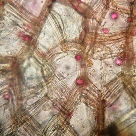 Cellule dibuccia di patata Cellule dibuccia di patata